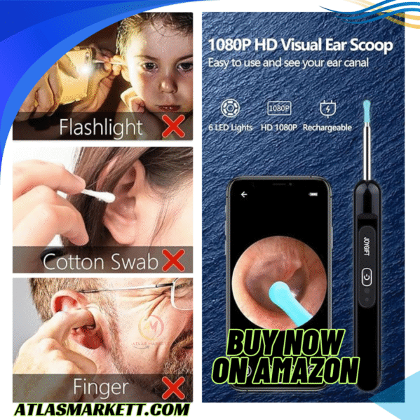Ear Wax Removal Camera 1080P Wireless Ear Cleaner Safe for Kids and Adults