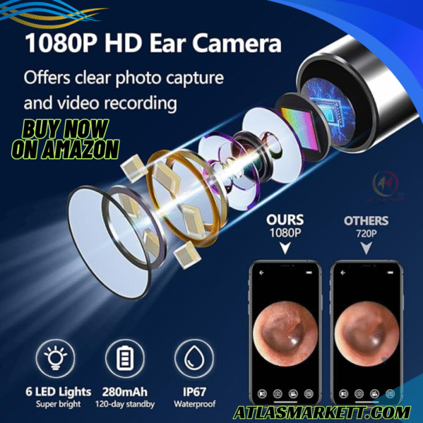 Wireless Ear Cleaner 1080P HD Camera for Safe Earwax Removal